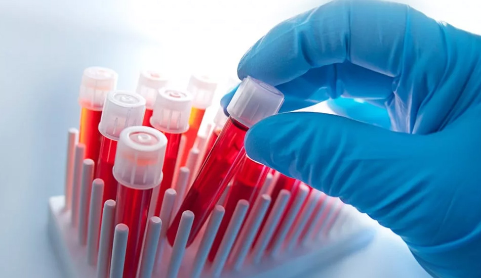 Гематология